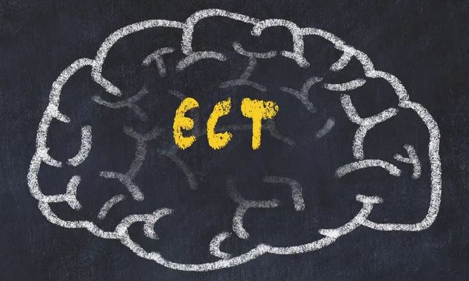 الکتروشوک درمانی(ECT)